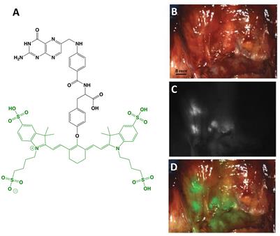 Receptor-Targeted Fluorescence-Guided Surgery With Low Molecular Weight Agents